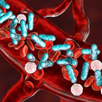 Visual representation of sepsis with blue, pink and red items in blood vessels 